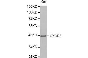 Western blot analysis of extracts of Raji cell lines, using CXCR5 antibody.