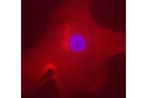 Immunofluorescent staining of MLXIPL in human hepatocyte using MLXIPL polyclonal antibody . (MLXIPL antibody  (AA 800-852))