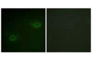 Immunofluorescence analysis of HeLa cells, using Syndecan4 (Ab-179) antibody. (SDC4 antibody  (Ser179))