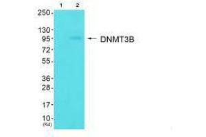 Western blot analysis of extracts from HuvEc cells (Lane 2), using DNMT3B antiobdy. (DNMT3B antibody  (N-Term))