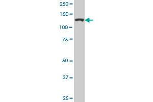 CAND1 monoclonal antibody (M05), clone 1G5. (CAND1 antibody  (AA 1-100))
