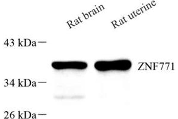 ZNF771 antibody