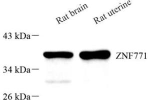 Western blot analysis of Znf771 (ABIN7076273)at dilution of 1: 500 (ZNF771 antibody)