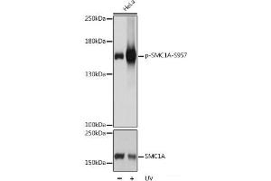 Western blot analysis of extracts of HeLa cells using Phospho-SMC1A(S957) Polyclonal Antibody at dilution of 1:1000. (SMC1A antibody  (pSer957))