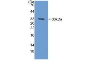 Detection of Recombinant PCYOX1, Mouse using Polyclonal Antibody to Prenylcysteine Oxidase 1 (PCYOX1)