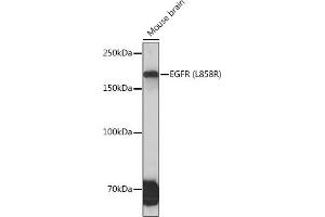 Western blot analysis of extracts of Mouse brain cells, using EGFR (L858R) Rabbit mAb (ABIN7266981) at 1:500 dilution. (EGFR antibody)