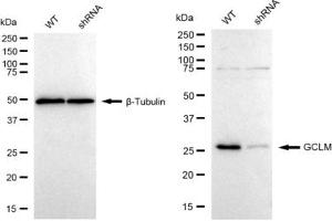Western blotting analysis using GCLM antibody (ABIN7798743). (Recombinant GCLM antibody)