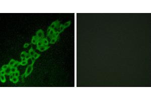 Peptide - +Western blot analysis of extracts from A549 cells, using GPR32 antibody. (GPR32 antibody  (Internal Region))