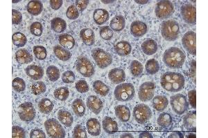 Immunoperoxidase of monoclonal antibody to KRT4 on formalin-fixed paraffin-embedded human small Intestine. (KRT4 antibody  (AA 194-300))