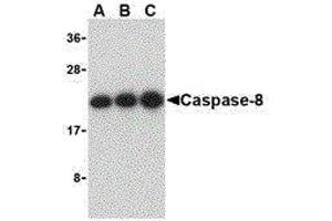 Western Blotting (WB) image for anti-Caspase 8 (CASP8) (C-Term) antibody (ABIN2477922) (Caspase 8 antibody  (C-Term))