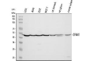 Western blot analysis of EIF4A1 using anti-EIF4A1 antibody (ABIN7603125). (EIF4A1 antibody  (N-Term))