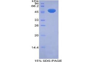 SDS-PAGE analysis of Rat Pregnane X Receptor Protein. (NR1I2 Protein)