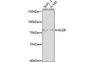 Western blot analysis of extracts of various cell lines, using  antibody (ABIN7265697) at 1:1000 dilution.