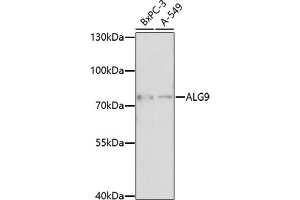 ALG9 抗体  (AA 439-618)