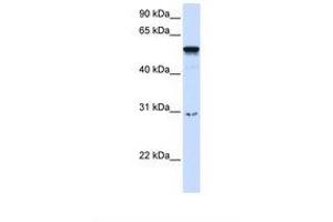 Image no. 1 for anti-Autoimmune Regulator (AIRE) (AA 218-267) antibody (ABIN6737664) (AIRE antibody  (AA 218-267))
