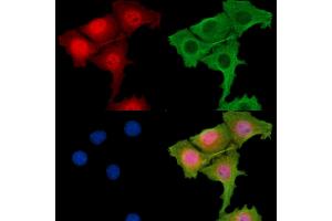 ABIN7095862 and ABIN7099924 staining HepG2 cells by IF/ICC.