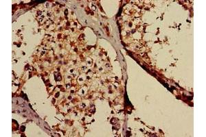 Immunohistochemistry of paraffin-embedded human testis tissue using ABIN7171472 at dilution of 1:100 (TAF6L antibody  (AA 345-433))