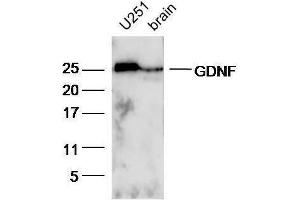Lane 1:U251 lysates and Lane 2: Mouse brain lysates probed with Rabbit Anti-GDNF Polyclonal Antibody, Unconjugated  at 1:5000 for 90 min at 37˚C. (GDNF antibody  (AA 121-211))