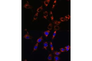 Immunofluorescence analysis of NIH/3T3 cells using  Rabbit pAb (ABIN6133587, ABIN6137053, ABIN6137054 and ABIN6224632) at dilution of 1:100. (Aquaporin 8 antibody  (AA 50-150))