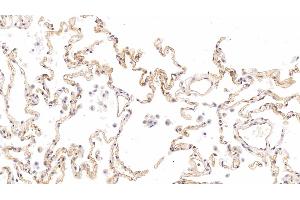 Immunohistochemistry (IHC) image for anti-Intercellular Adhesion Molecule 1 (ICAM1) (AA 41-464) antibody (ABIN7425926)