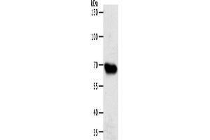 Western Blotting (WB) image for anti-ATP-Binding Cassette, Sub-Family G (WHITE), Member 1 (ABCG1) antibody (ABIN2426499) (ABCG1 antibody)