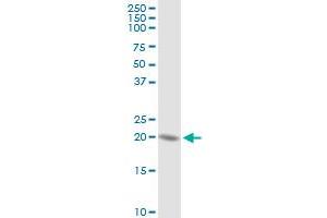 HSPC111 MaxPab rabbit polyclonal antibody. (NOP16 antibody  (AA 1-178))