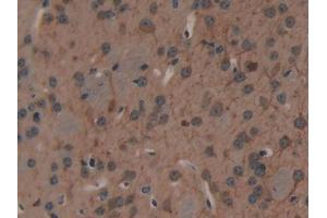 Detection of MAP1A in Mouse Brain Tissue using Polyclonal Antibody to Microtubule Associated Protein 1A (MAP1A)