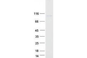 Western Blotting (WB) image for Phosphoinositide-3-Kinase, Class 3 (PIK3C3) protein (Myc-DYKDDDDK Tag) (ABIN2728945)