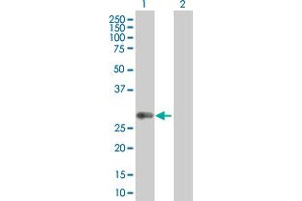 HLA-DQB1 antibody  (AA 1-261)