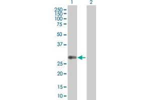 Western Blot analysis of HLA-DQB1 expression in transfected 293T cell line by HLA-DQB1 MaxPab polyclonal antibody.