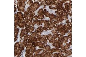 Immunohistochemical staining of human pancreas with FANCB polyclonal antibody  shows strong cytoplasmic positivity in exocrine glandular cells.