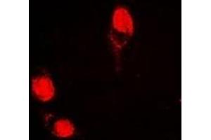 Immunofluorescent analysis of AGFG1 staining in HepG2 cells. (AGFG1 antibody)
