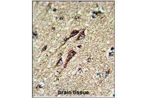 Formalin-fixed and paraffin-embedded human brain tissue reacted with ATP5B Antibody (Center), which was peroxidase-conjugated to the secondary antibody, followed by DAB staining.