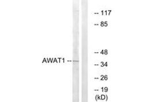 Western blot analysis of extracts from 293 cells, using AWAT1 Antibody. (AWAT1 antibody  (AA 261-310))