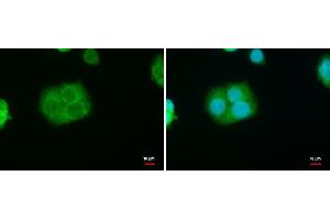 ICC/IF Image StAR antibody detects StAR protein at mitochondria by immunofluorescent analysis. (STAR antibody)
