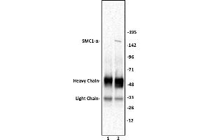 SMC1- a antibody (pAb) tested by Immunoprecipitation. (SMC1A antibody  (C-Term))