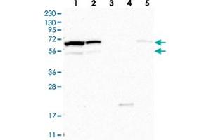 Western blot analysis of Lane 1: RT-4, Lane 2: U-251 MG, Lane 3: Human Plasma, Lane 4: Liver, Lane 5: Tonsil with CPSF3L polyclonal antibody . (CPSF3L antibody)