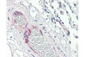 Anti-PTGIS antibody IHC of human lung, vessel. (PTGIS antibody  (AA 475-490))
