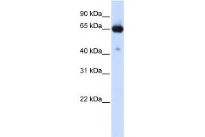 Western Blotting (WB) image for anti-Solute Carrier Family 39 (Zinc Transporter), Member 4 (SLC39A4) (N-Term) antibody (ABIN2781654)