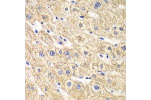 Immunohistochemistry of paraffin-embedded human liver injury using ACADS antibody at dilution of 1:100 (x40 lens). (ACADS antibody)