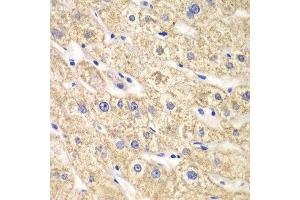Immunohistochemistry of paraffin-embedded human liver injury using ACADS antibody at dilution of 1:100 (x40 lens).