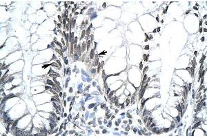 Human Stomach; MKX antibody - middle region in Human Stomach cells using Immunohistochemistry (MKX antibody  (Middle Region))