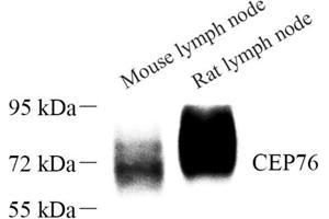 Cep76 antibody