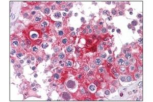 Immunohistochemistry (IHC) image for anti-Lactate Dehydrogenase A (LDHA) antibody (ABIN614512) (Lactate Dehydrogenase A antibody)