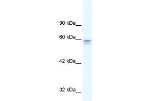 Human HepG2; WB Suggested Anti-MTF1 Antibody Titration: 5.