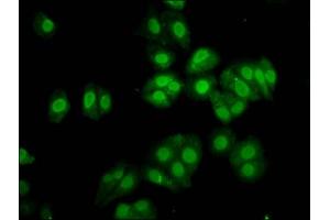 Immunofluorescence staining of HepG2 cells with ABIN7172627 at 1:133, counter-stained with DAPI. (SOX3 antibody  (AA 84-206))