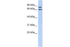 WB Suggested Anti-FSIP1 Antibody Titration: 0. (FSIP1 antibody  (Middle Region))