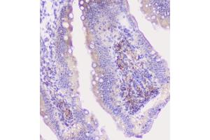 IHC analysis of CFP using anti-CFP antibody (ABIN6719298). (CFP antibody)