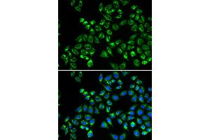 Immunofluorescence analysis of HeLa cells using C1QBP antibody. (C1QBP antibody)