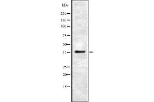 Western blot analysis UCHL5 using HeLa whole cell lysates (UCHL5 antibody  (Internal Region))